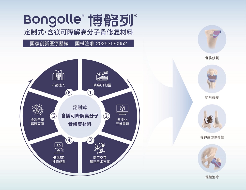 定制式含镁可降解高分子骨修复材料