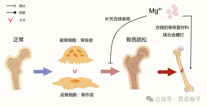 图2 镁元素与骨质疏松发生发展有关,并且含镁的骨修复材料将成为医生重要的治疗手段