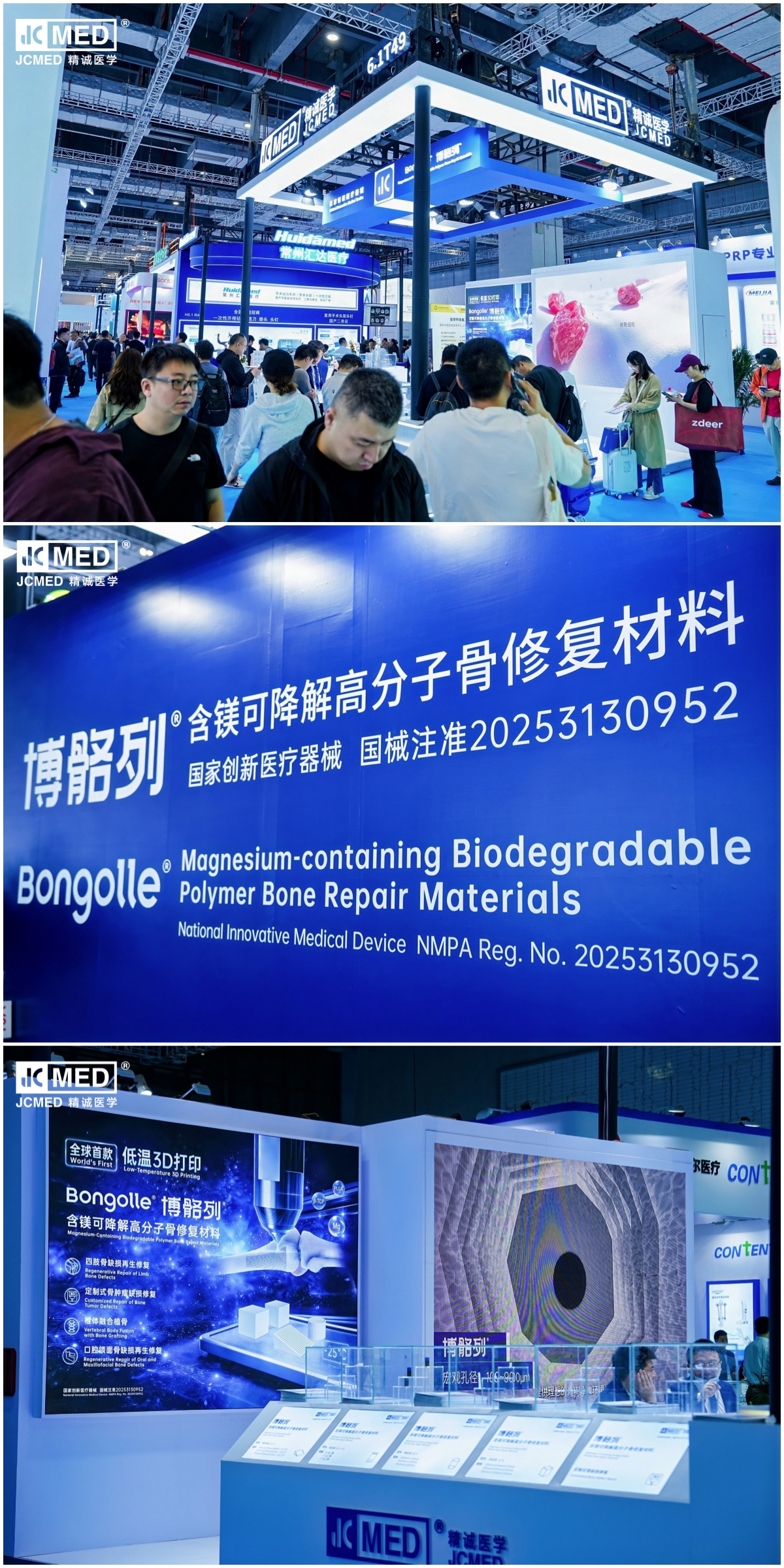 全球首款含镁骨修复材料亮相CMEF